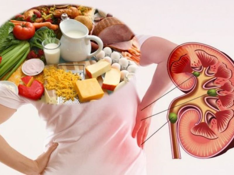 Dinh dưỡng trong hội chứng thận hư